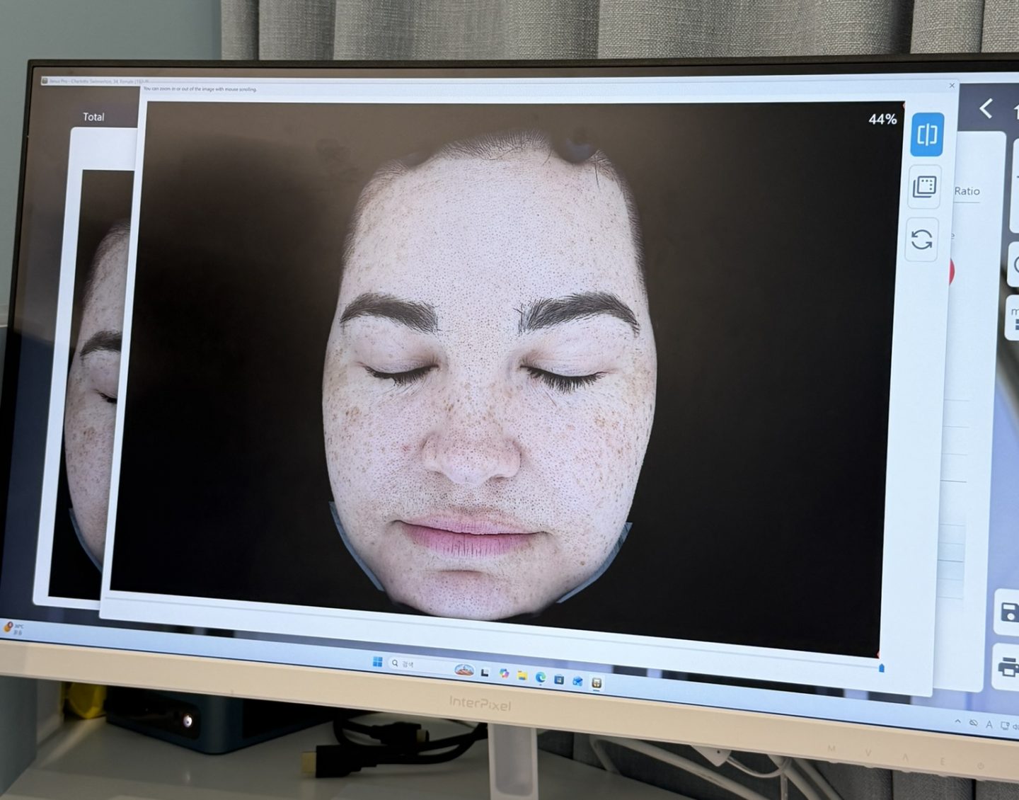 JANUS Pro skin analysis results displayed at Seoulistique in Seoul